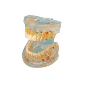 Transparent adult tooth model